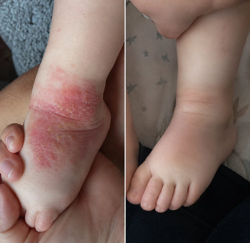sam, 1 jaar